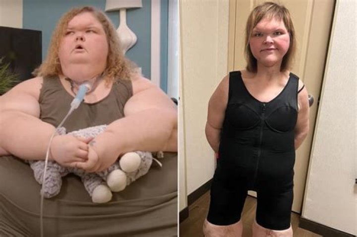 Amy Slaton struggles with smoking addiction after dramatic weight loss.
